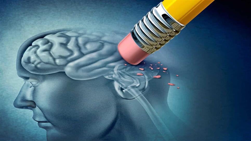 Relacionan niveles elevados de proteína amiloide con alzheimer