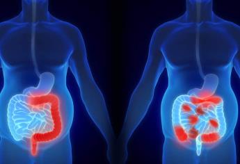 Enfermedad de Crohn, poco frecuente pero incurable