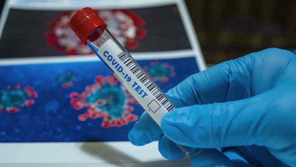Salud Digna ofrecerá unidades de pruebas diagnósticas de Covid-19 Salud Digna ofrecerá unidades de pruebas diagnósticas de Covid-19