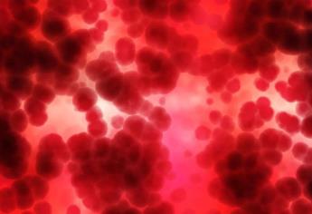 Conoce las causas de la hipercalcemia