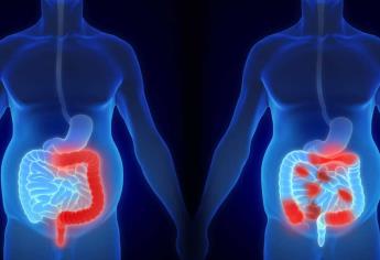 Jóvenes, los más afectados por enfermedad inflamatoria intestinal