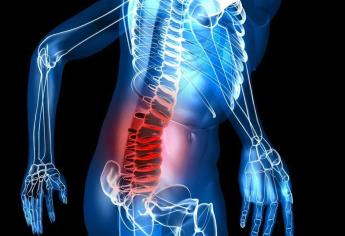 Hernias de disco, más frecuentes en jóvenes: IMSS