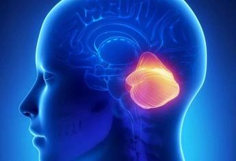 La malformación de Chiari puede ser asintomática