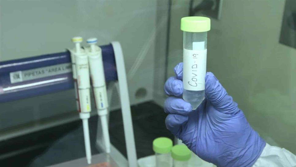 Investigadores del IMSS participan en desarrollo de vacuna contra el Covid-19