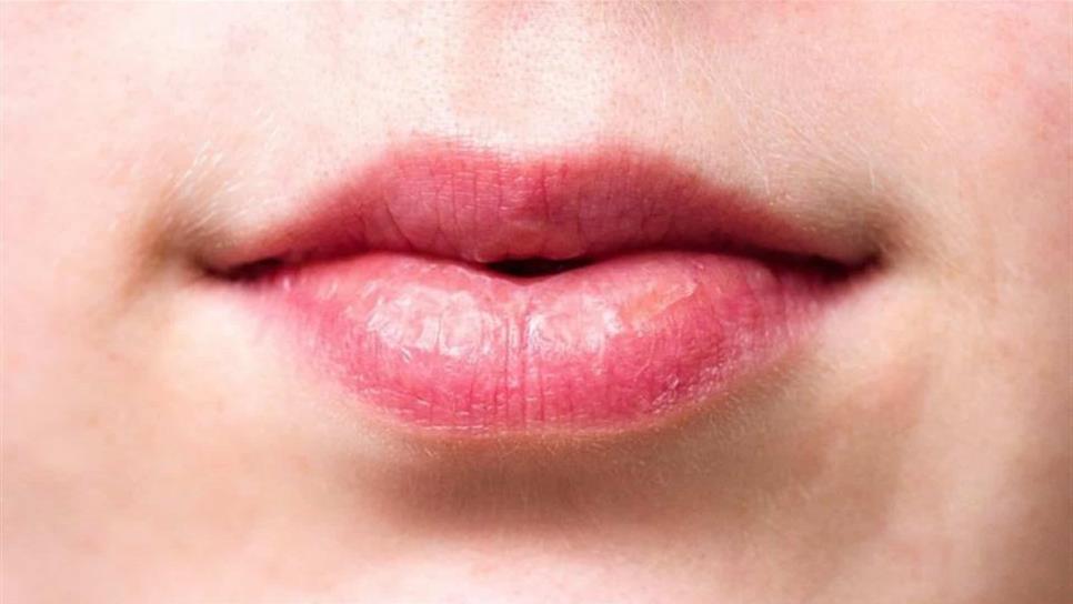 Despertar con la boca amarga o seca es síntoma de enfermedades graves