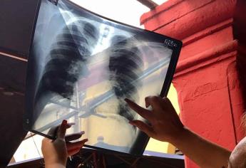 Niega IMSS estudios y tratamiento médico a paciente con neumonía, denuncia