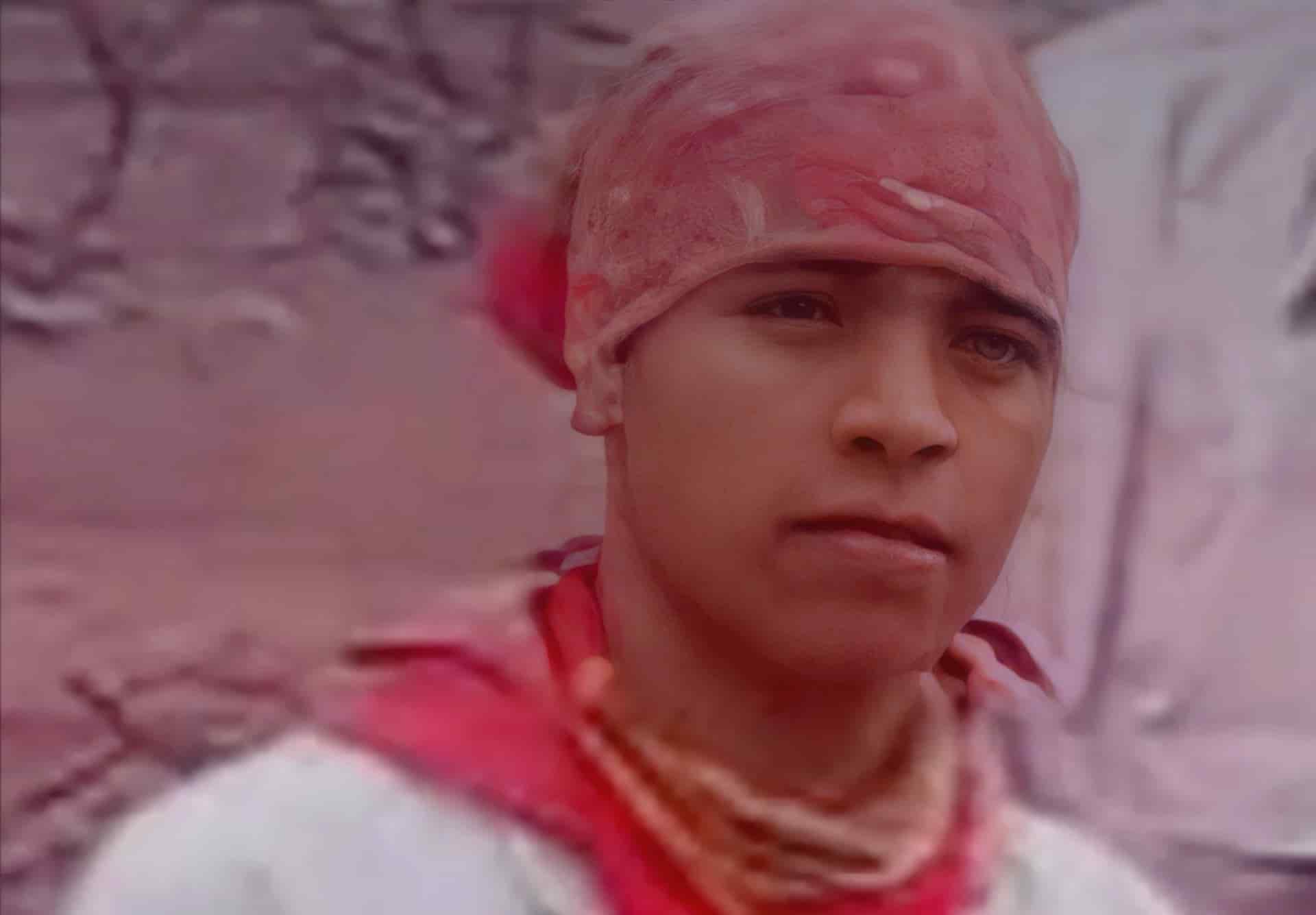 Joven danzante de venado requiere medicamento de quimioterapia para vencer la leucemia