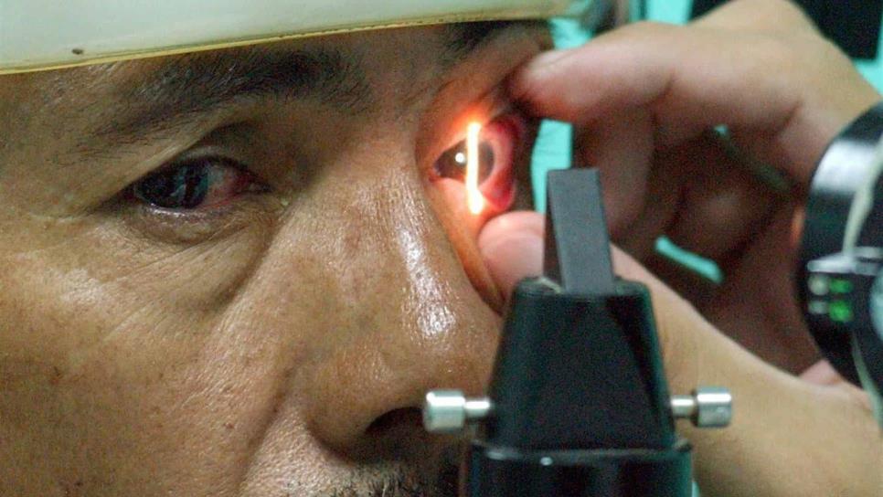 El glaucoma es la primera causa de ceguera en México