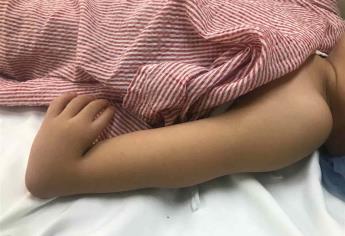 Irving solicita apoyo económico para cirugía en su brazo izquierdo
