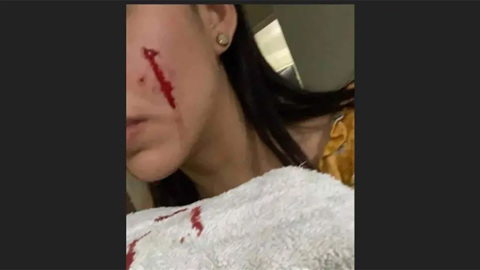No soy cómplice: novia de presunto agresor de Rodolfo