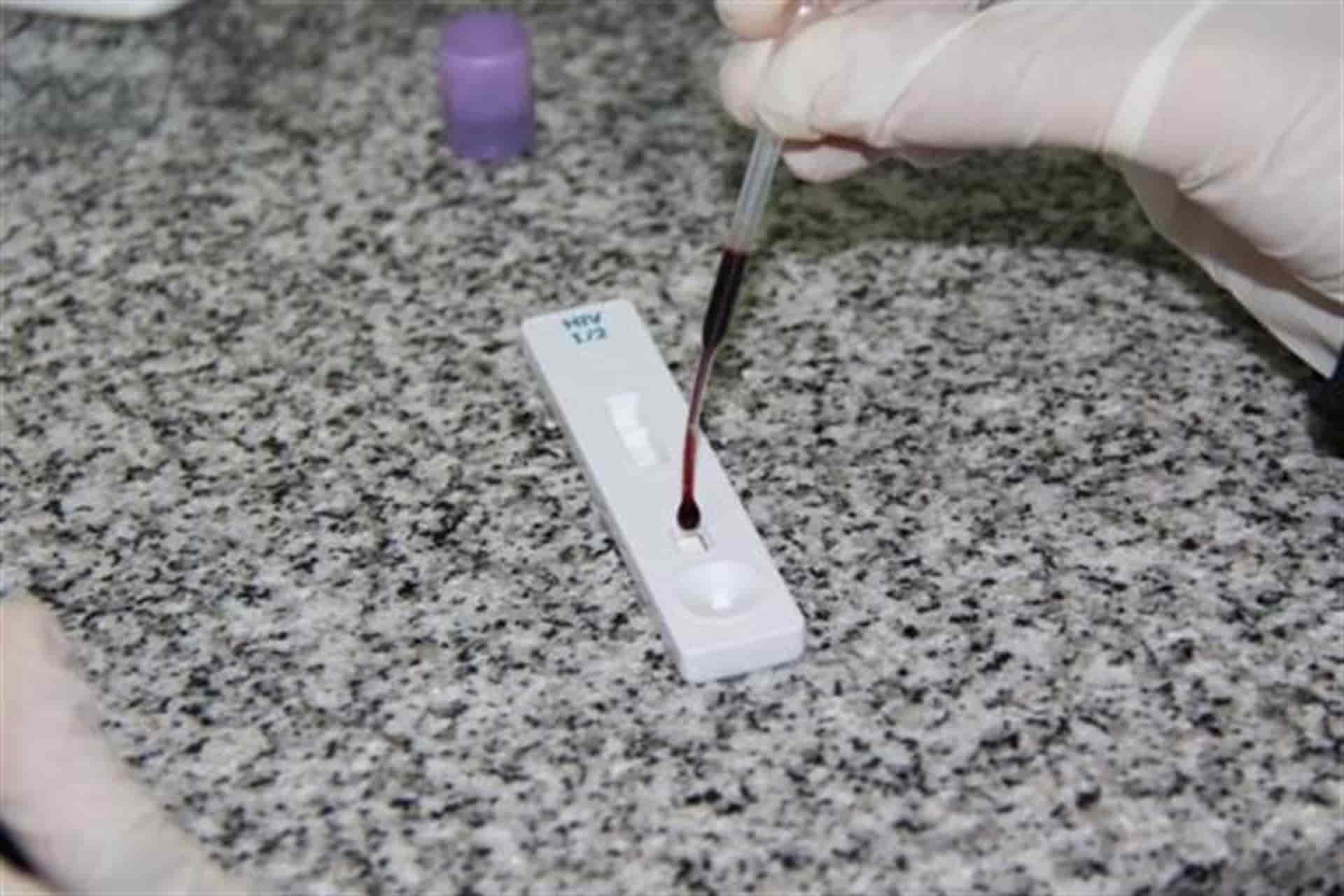 Incrementan casos de sida en jóvenes de 25 años en Sinaloa