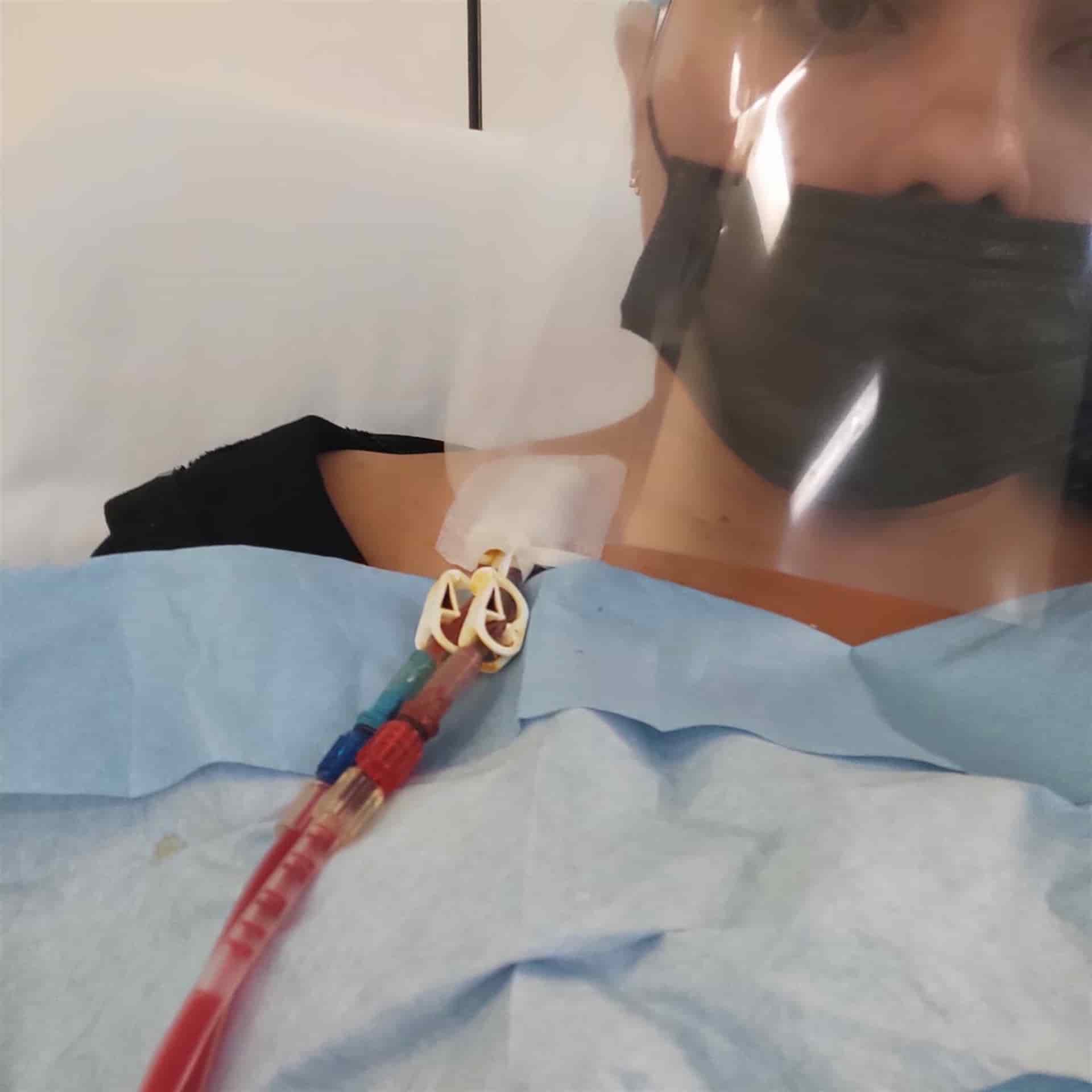 Paciente de hemodiálisis denuncia negligencia; se queja de una máquina del IMSS que no sirve