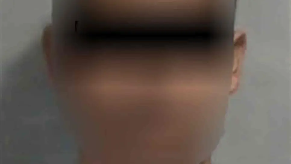 Le tumba diente de un puñetazo a su pareja y lo detienen policías