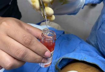 Donan dos córneas para trasplantes en el IMSS Mazatlán