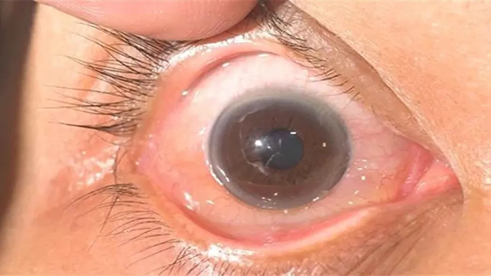 Joven rifa celular para cirugías de los ojos de su mamá