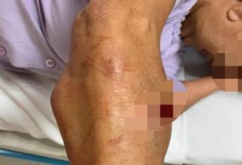 Perro ataca a mujer mayor en la colonia Scally en Los Mochis