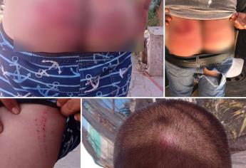 Joven de Los Mochis denuncia a militares de golpearlo y amenazarlo