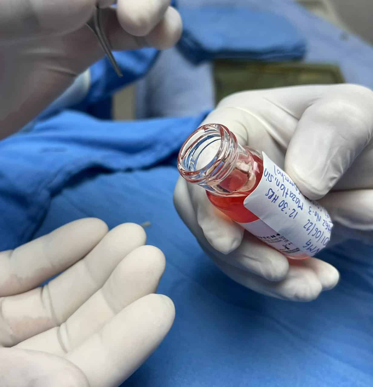 Hombre de Jalisco devolverá la vista a dos personas con trasplante de corneas