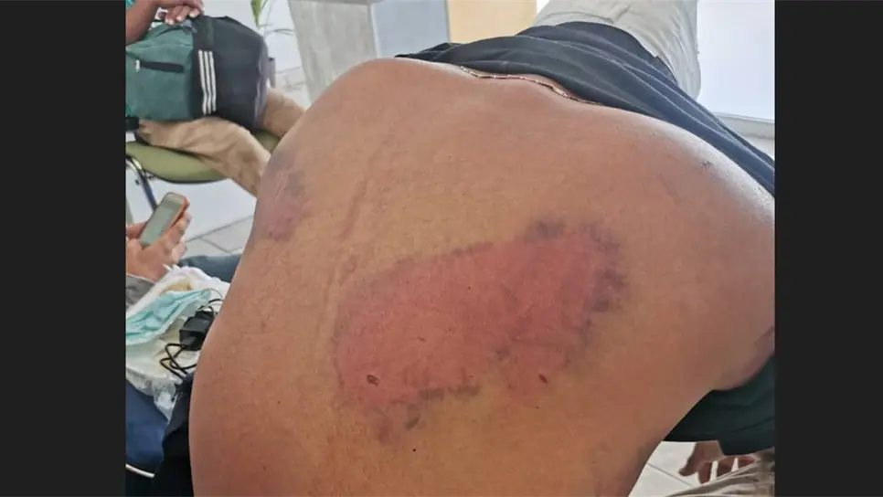 Atacan a migrantes hondureños en estación del tren en Culiacán