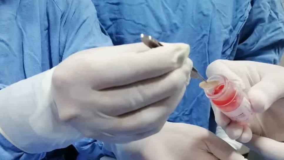 Tres pacientes en Mazatlán donan sus córneas