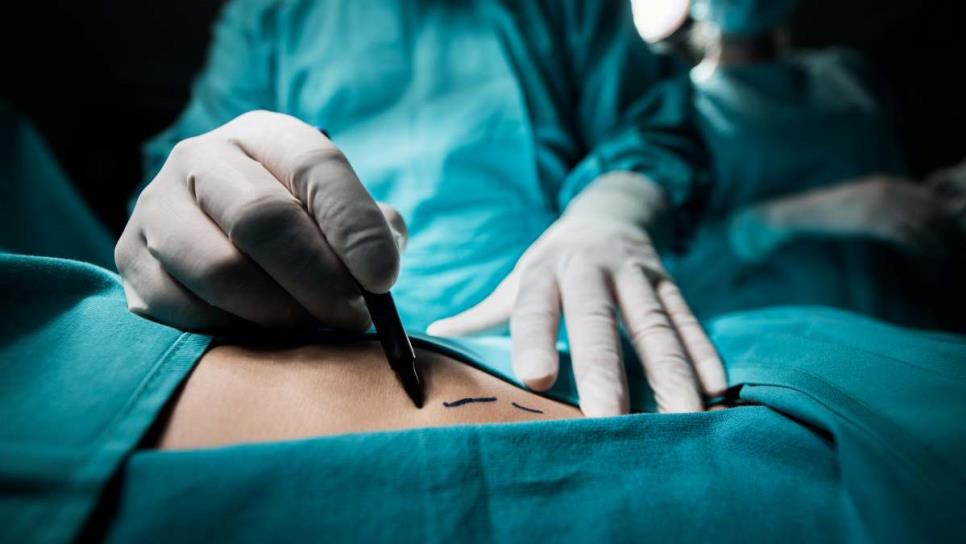 Coepris alerta de falso cirujano estético en San Luis Potosí