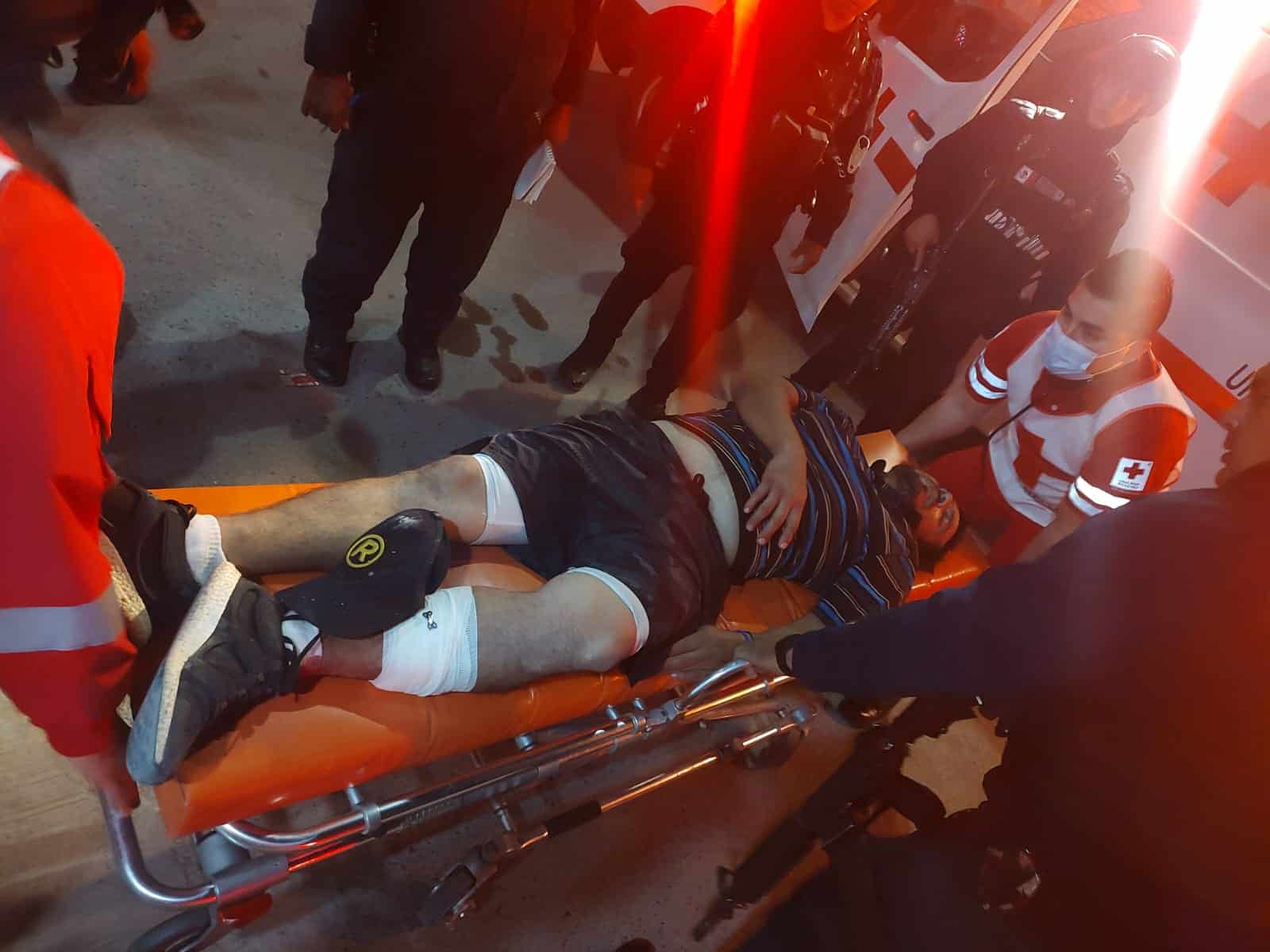 Iba caminando a la tienda y recibe un balazo en la pantorrilla