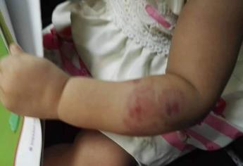 Maestra de Culiacán muerde a niña en el brazo; Fiscalía investiga