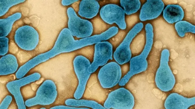 ¿Qué es el virus de Marburgo? conoce lo que provoca esta enfermedad.| FOTO: Internet.