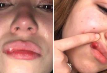 Supuesta agresión a joven tras concierto no se denunció a Unidad de Equidad y Género de Ahome