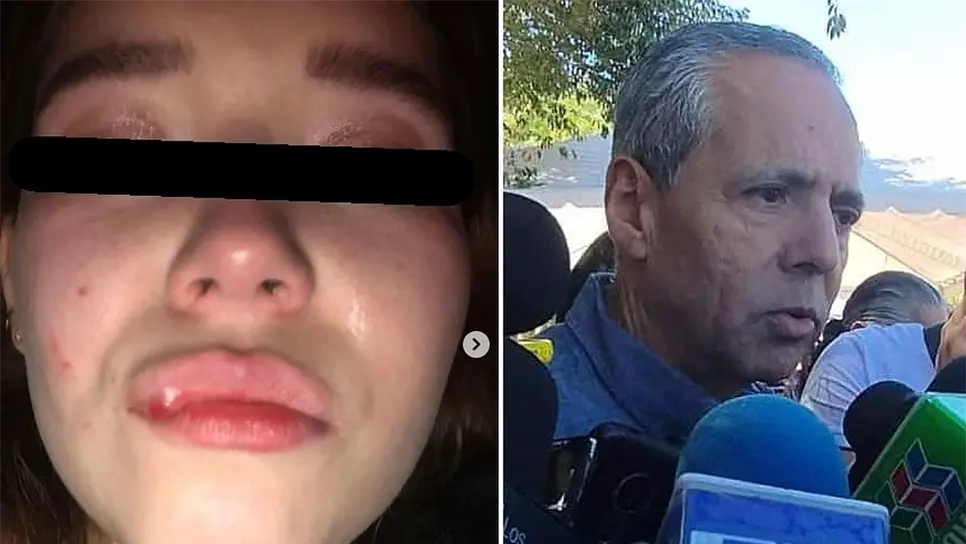 El Alcalde manifestó sus disculpas al haber dicho previamente que sí existía un vínculo. FOTO: Luz Noticias.