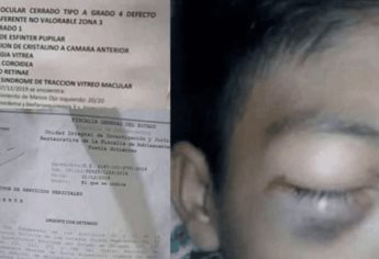 Propinan brutal golpiza a estudiante de secundaria