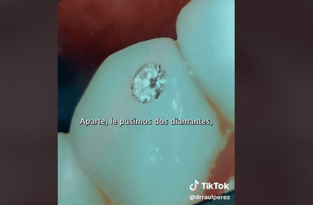 Imagen Placeholder Imagen Placeholder