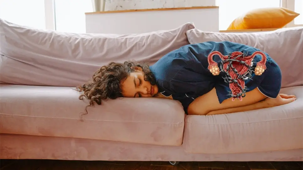 FOTO: Endometriosis, dolor menstrual.