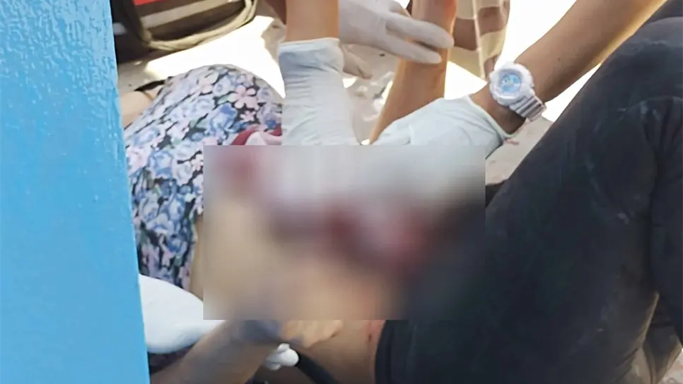 En pleno día de conmemoración LGBTQ+, atacan con cuchillo a persona de la comunidad. FOTO: Cortesía.