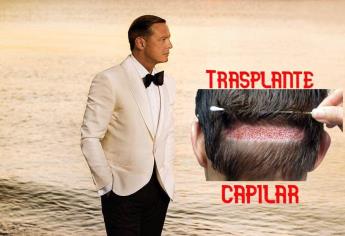 Luis Miguel se trasplanta cabello y luce nueva imagen