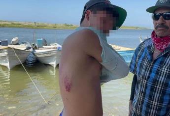 «Nos pasaron por encima; me dijeron que me iban a arrojar al mar», menor herido por marinos en Las Lajitas