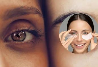 ¿Ojeras o bolsas en tus ojos? Así puedes desaparecerlas