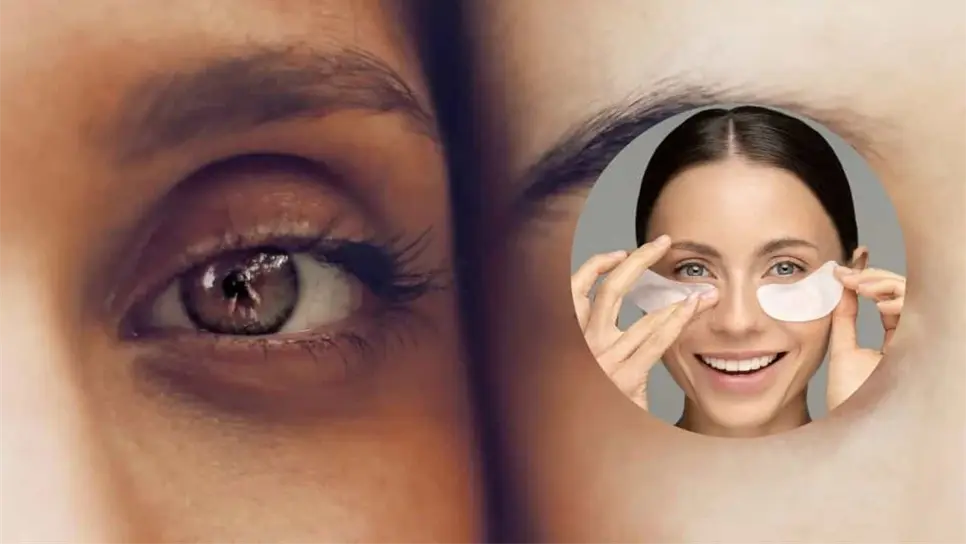Las ojeras y las bolsas en los ojos no son lo mismo. FOTO: Hipertextual / Doctora Pérez Sevilla