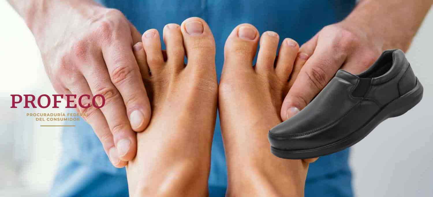 FOTO: Pie diabético.