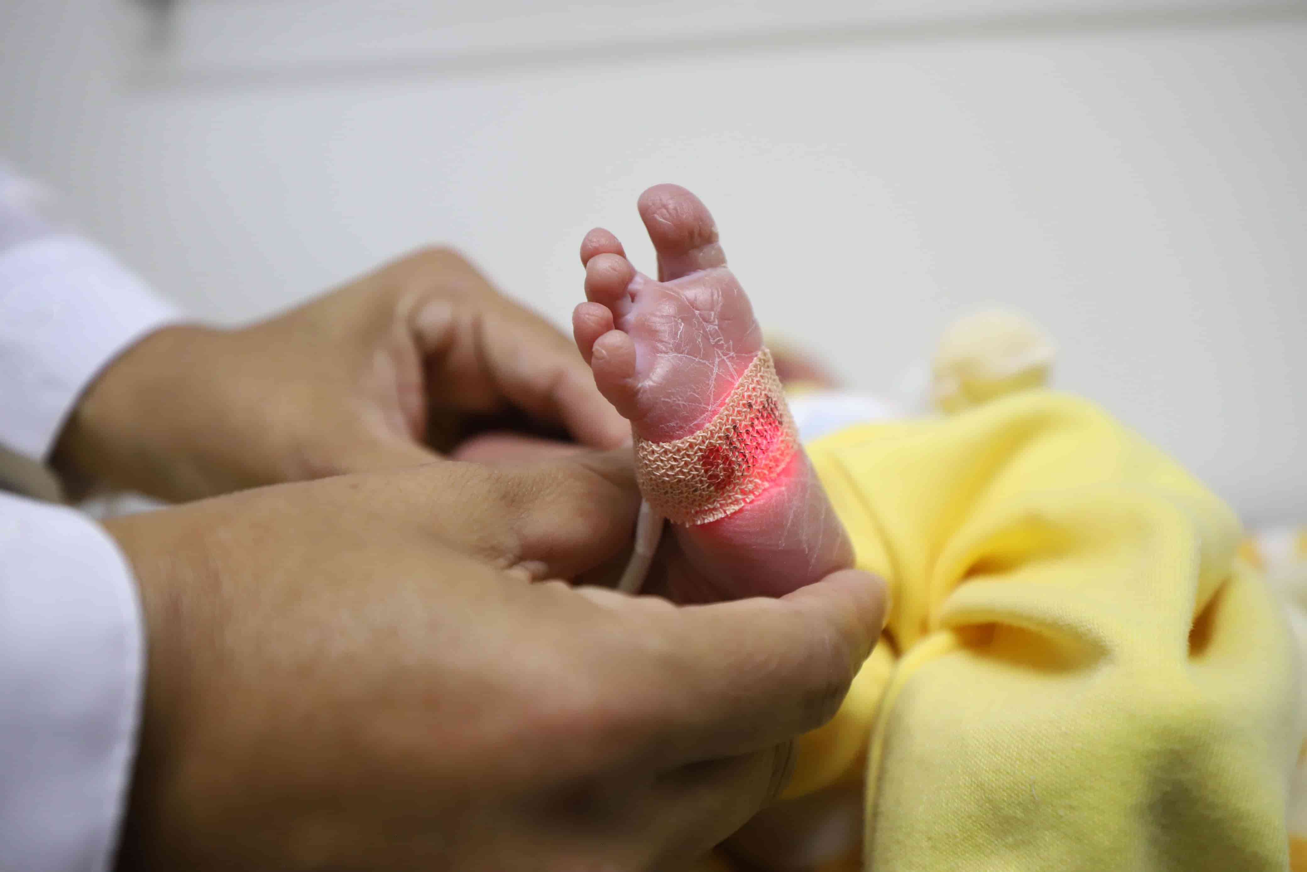 Detectan en Sinaloa 10 casos de cardiopatías congénitas en recién nacidos 