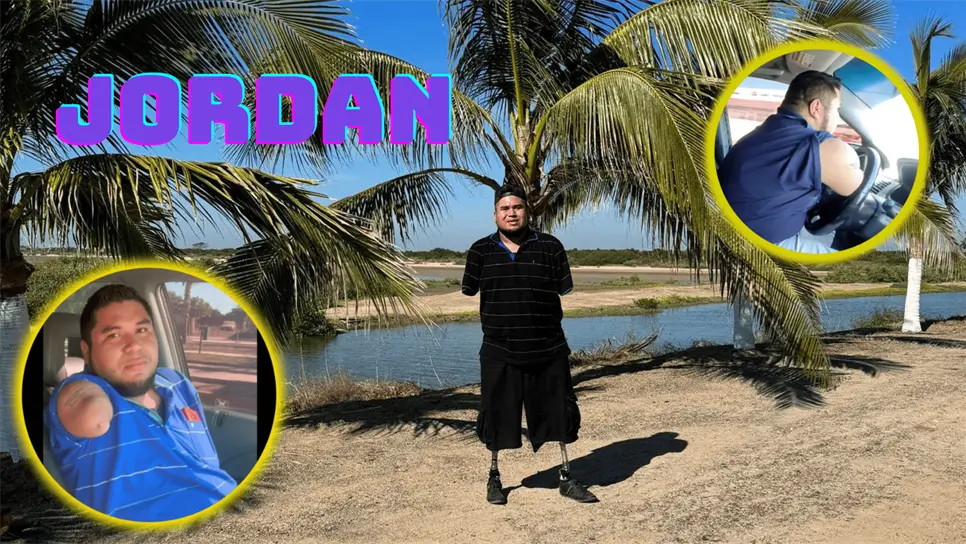 FOTO: Jordan, el hombre sin manos y pies.