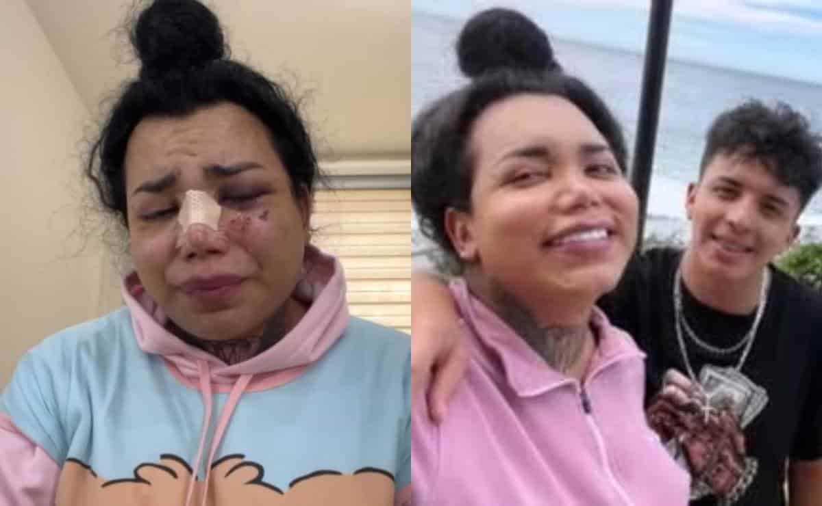 Paola Suárez admite que todavía quiere a su novio a pesar de la golpiza que le dio