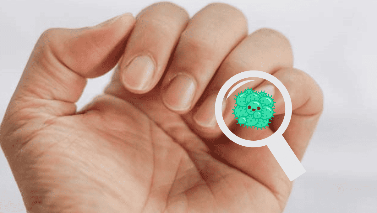 La onicomicosis en las manos es menos común, en casos avanzados, lo mejor es visitar a un especialista.