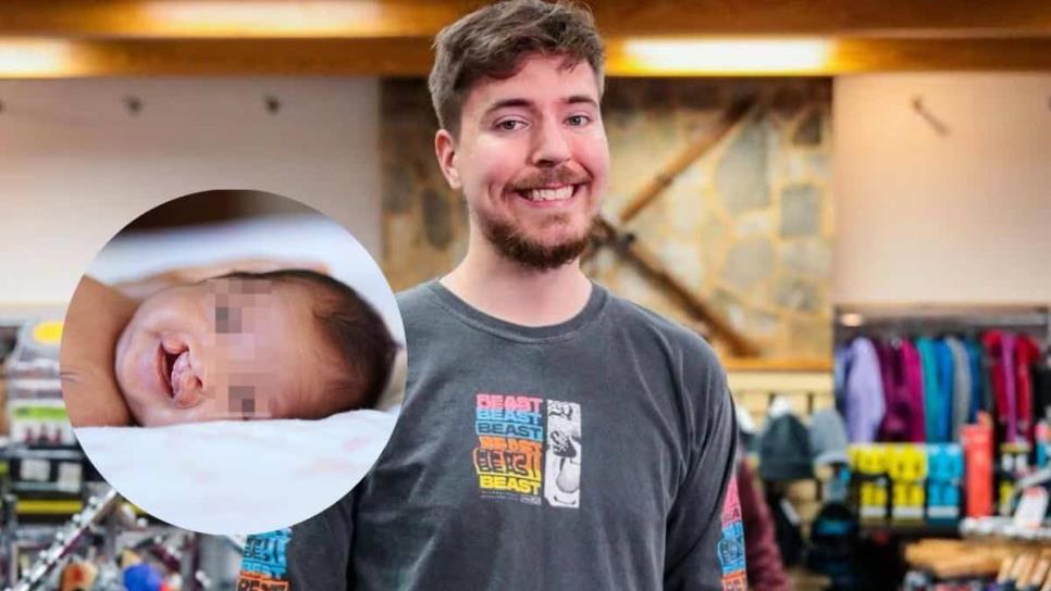 Youtuber Mr. Beast regala 100 cirugías a niños con labio leporino en México