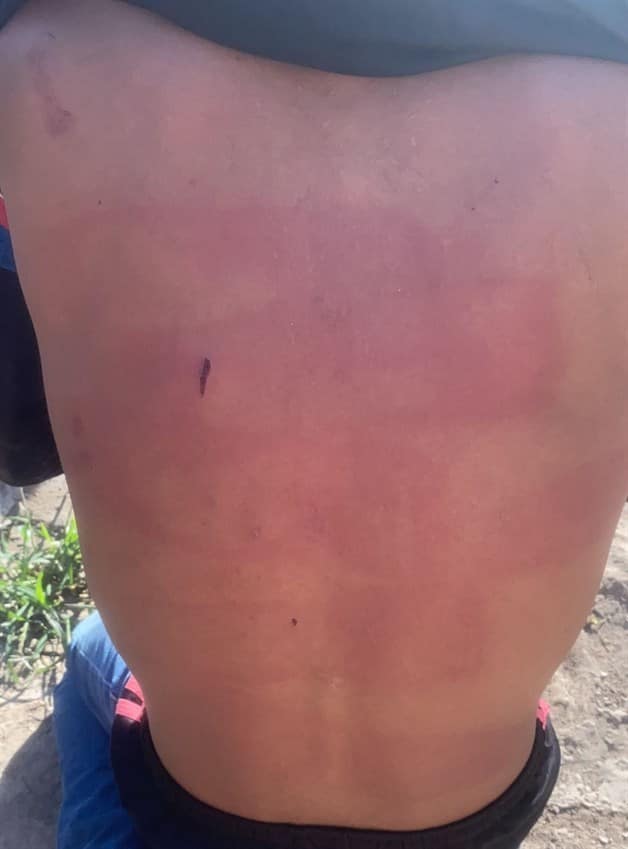 Imagen Placeholder Imagen Placeholder
