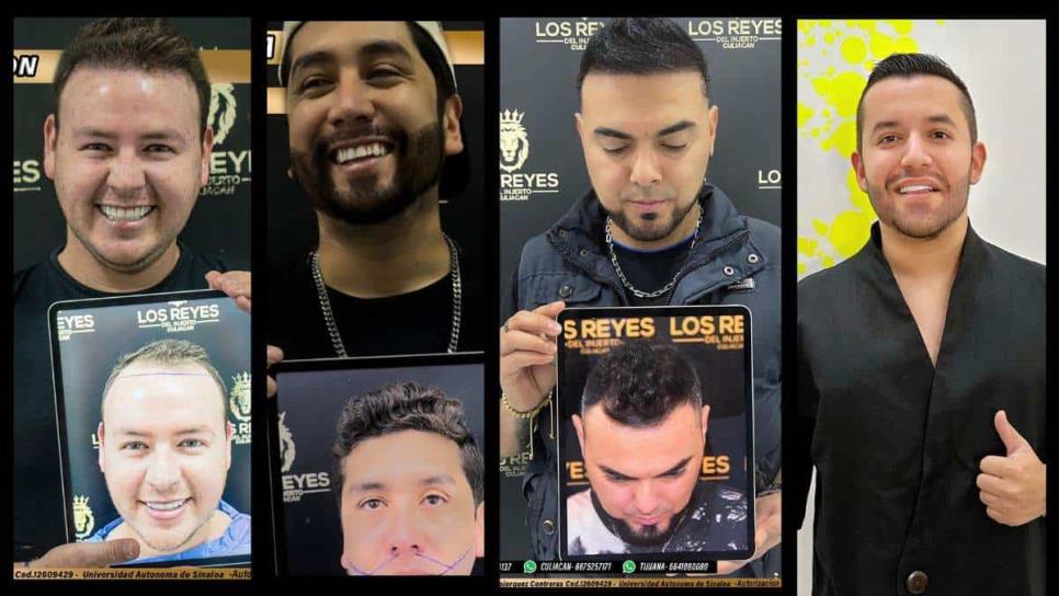 ¿Qué famosos se pusieron barba o cabello? Ellos son Los Reyes del Injerto en Culiacán