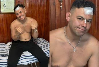 ¿Qué le pasó a El Yaki? Tremenda herida le quedó al exvocalista de El Recodo tras accidente | FOTOS