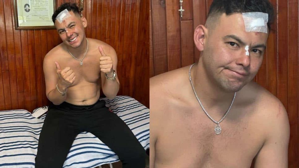 ¿Qué le pasó a El Yaki? Tremenda herida le quedó al exvocalista de El Recodo tras accidente | FOTOS