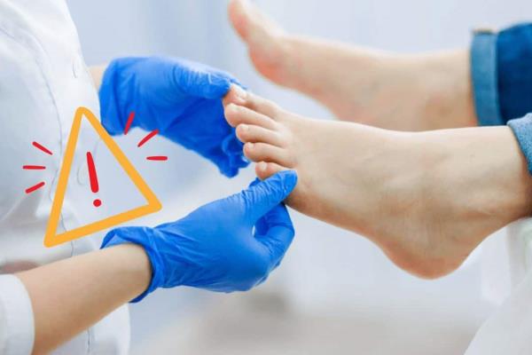 Así puedes eliminar el mal olor de tus pies con simples remedios caseros