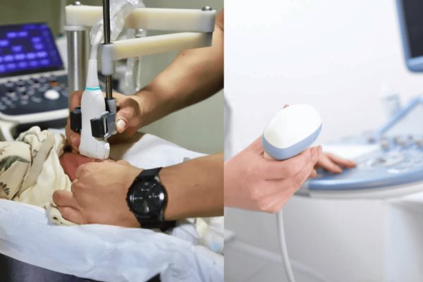 Tamiz de cadera: este es el único hospital de Sinaloa que realiza este importante examen a bebés